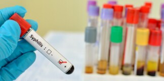 Gloved hand holding a test tube labeled 'Syphilis' with a positive result mark; colorful vials in the background.